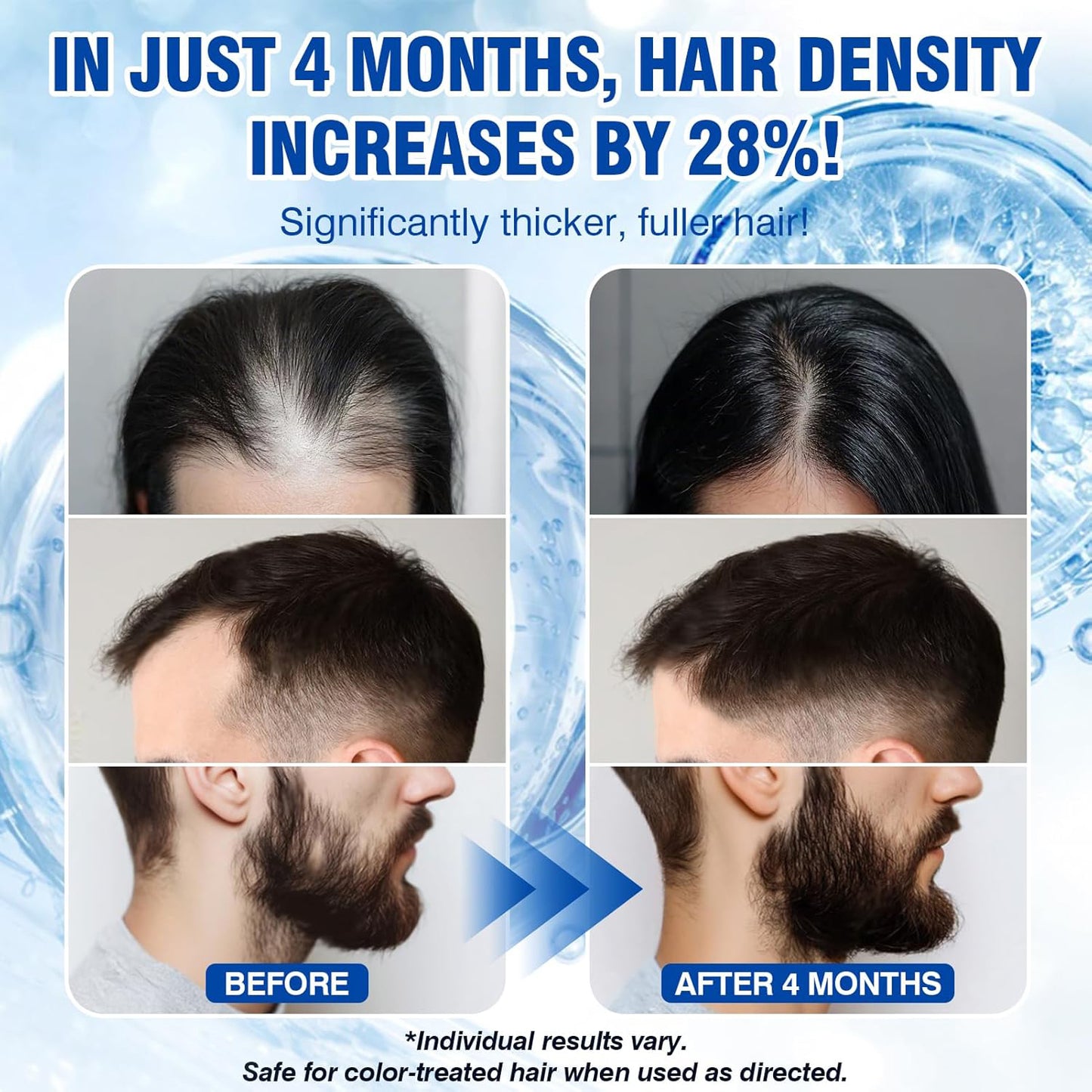 🔥🔥🔥HOT SALE 50% OFF💥 Fast Hair Growth Serum 💁‍♀️