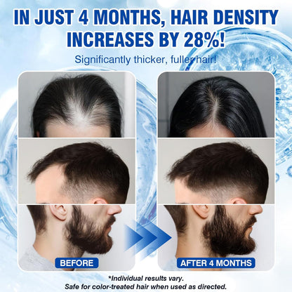 🔥🔥🔥HOT SALE 50% OFF💥 Fast Hair Growth Serum 💁‍♀️