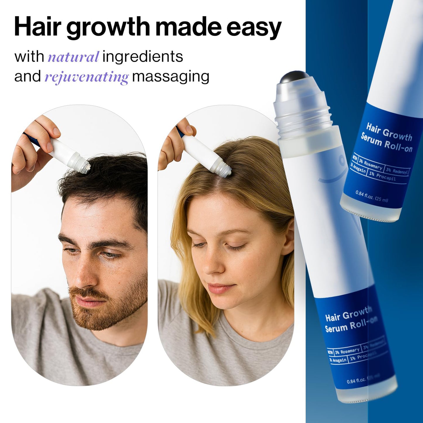 📢💥💥Final 5 Hours 54% OFF🔥Rosemary Hair Growth Serum Roll On 👩👦
