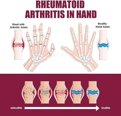 2PCS Perfectx Joint & Bone Cream,Perfectx Body Cream